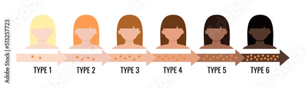 Obraz Fitzpatrick skin tone phototype  melanin index chart with female avatar. Graphic design element with type I II III IV V IV human skin hair color melanin content in the cell flat vector illustration