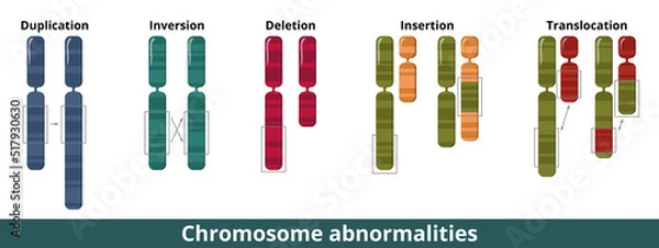 Fototapeta Chromosome abnormalities. Visualization of common chromosomal mutation or disorder. Numerical or structural abnormalities where is a missing, extra, or irregular portion of chromosomal DNA.