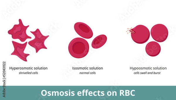 Fototapeta Osmosis effect on red blood cells. Depending on solution concentration (hyperosmotic, isosmotic, or hypoosmotic), erythrocytes can shrivel or swell and burst.