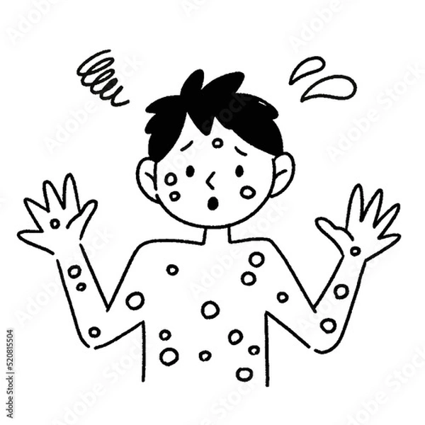 Obraz サル痘　男性　イラスト　白黒