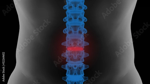 Obraz Lumbar vertebrae