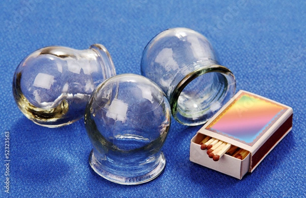 Fototapeta Cupping glass.