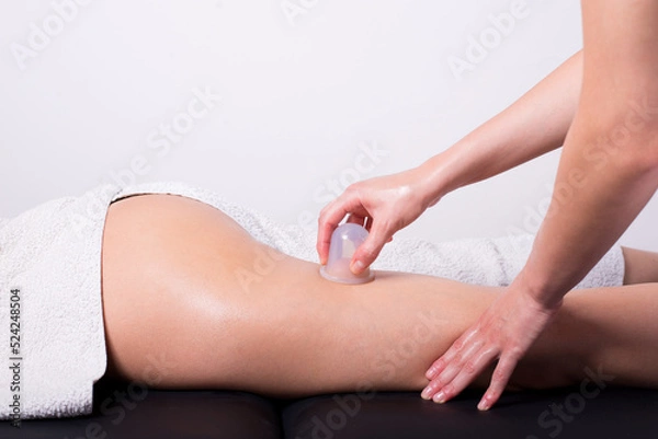 Obraz Girl getting massage in massage salon with suction cups, health spa