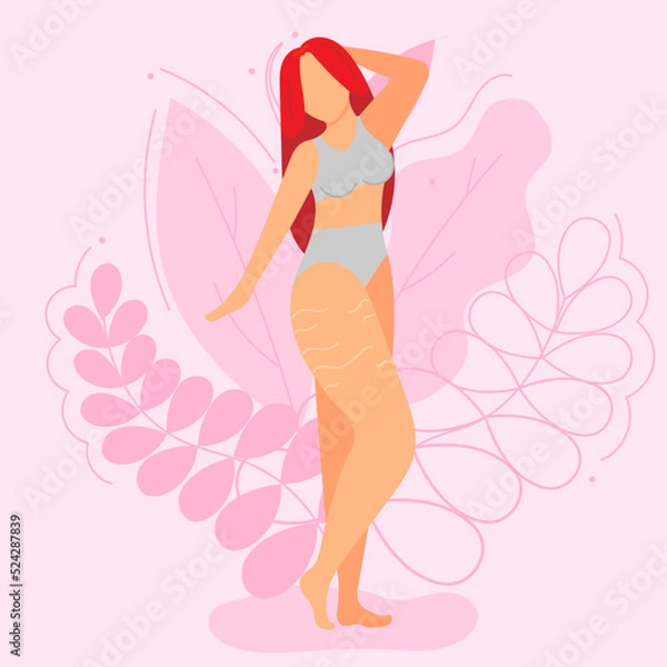 Obraz Vector illustration on the theme of body positivity. A girl with stretch marks on her thighs with long red hair on a background of beautiful leaves. Flat style