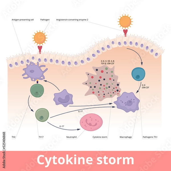 Fototapeta Cytokine storm. Hypercytokinemia during which the immune system causes a release of cytokines with help of macrophages, t helper cells, neutrophils.