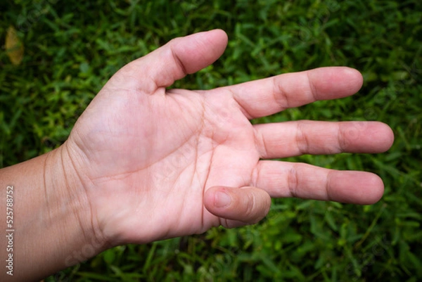 Fototapeta Trigger Finger lock on little finger of woman's front left hand, Suffering from pain, On green grass colour background,  Close up & Macro shot, Office syndrome, Health care concept