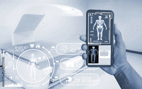 Obraz Close-up hand Doctor showing Image of DXA bone density scan on a smartphone in a woman of 50 years to prevent osteoporosis. blurry bone densitometer machine background.