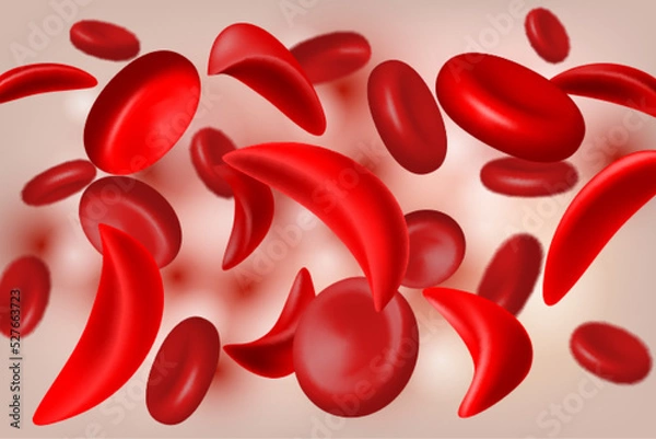 Fototapeta Normal red blood cell and sickle cell flow inside in artery.