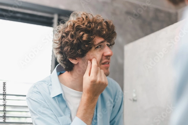 Obraz Portrait of young Caucasian man using his hand squeezed painful inflammatory acne on the cheek with. Skincare beauty concept. Handsome man looking at himself in the bathroom mirror Squeezing pimple.