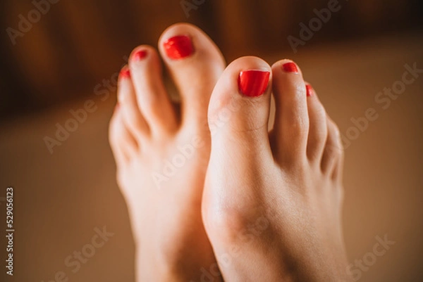 Obraz Pies con uñas rojas