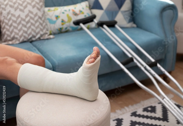 Obraz broken ankle and a leg cast. Leg splint