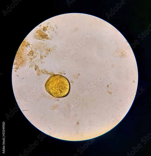 Obraz Urbanorium parasite analyzed under a microscope