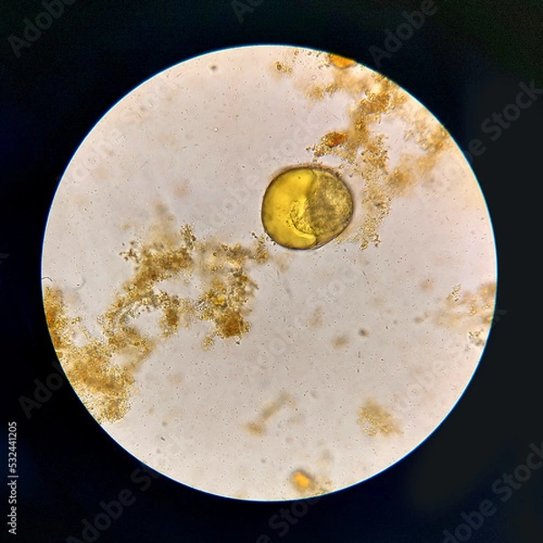 Obraz Urbanorium parasite analyzed under a microscope