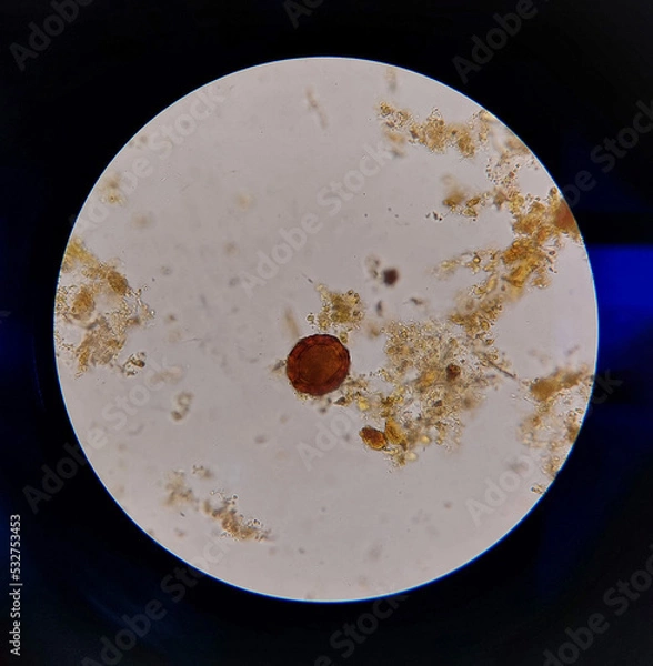 Obraz Ascaris lumbricoides egg laboratory microscope