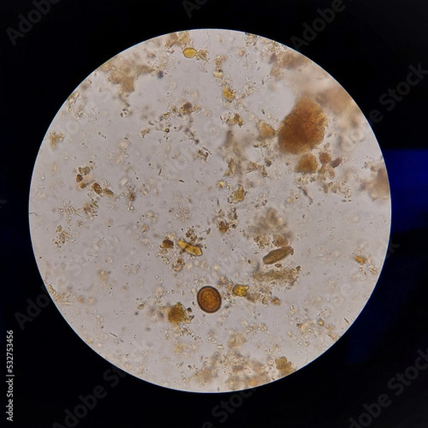 Obraz Taenia sp egg microscope  parasitology laboratory