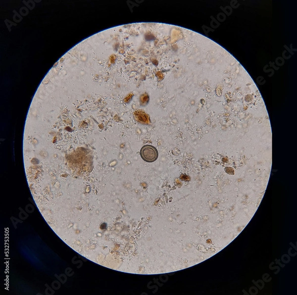 Obraz Taenia sp egg microscope  parasitology laboratory