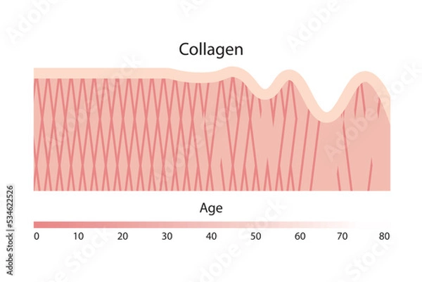 Obraz Collagen, a type of protein found in the skin, decreases with aging.