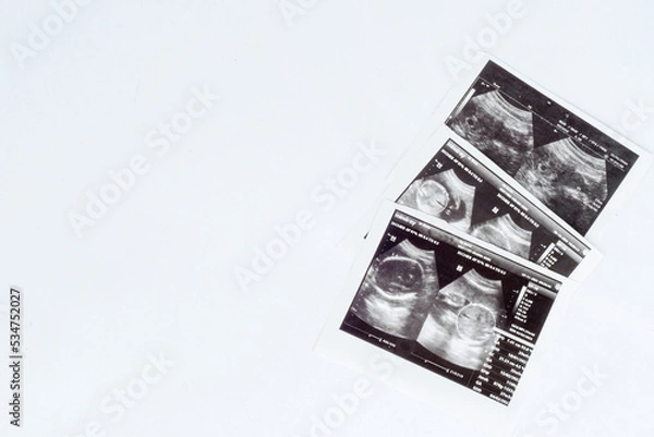 Obraz negative space ultrasound sheet on white background