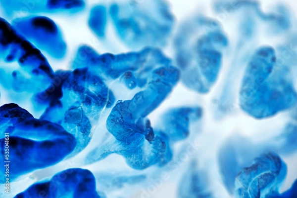Fototapeta Tumor cells under a microscope. Tissues affected by cancer cells under a microscope, Nauka. Cancer drugs.