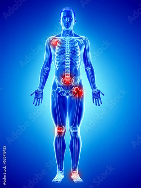 Fototapeta 3d rendered medically accurate illustration of a mans skeleton