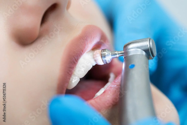 Fototapeta Close-up of teeth with brushing technology in the dentist's office. Dentistry and cleaning and whitening procedure.