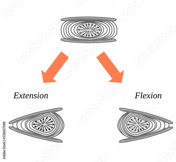 Obraz Deformation of the intervertebral disc due flexion and extension motion