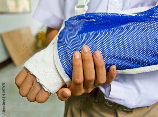 Fototapeta student's arm is broken