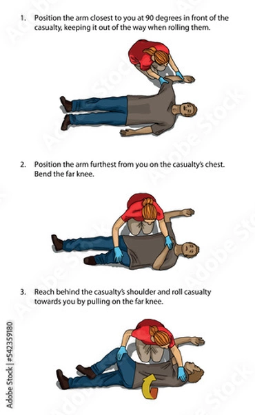 Obraz Vector illustration shows Recovery position (first aid).