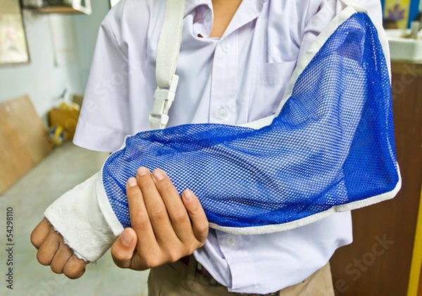 Obraz student's arm is broken