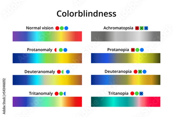 Obraz Vector illustration of color blindness or colorblindness. Normal vision, achromatopsia, protanomaly, protanopia, tritanomaly, tritanopia, deuteranomaly, deuteranopia. Color vision deficiency spectrum.