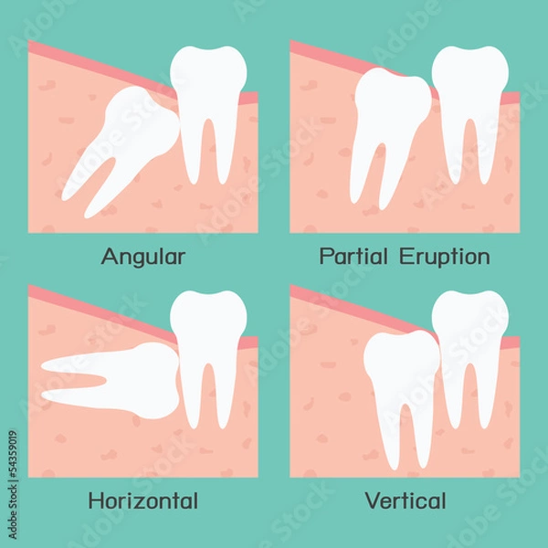Obraz Wisdom Tooth