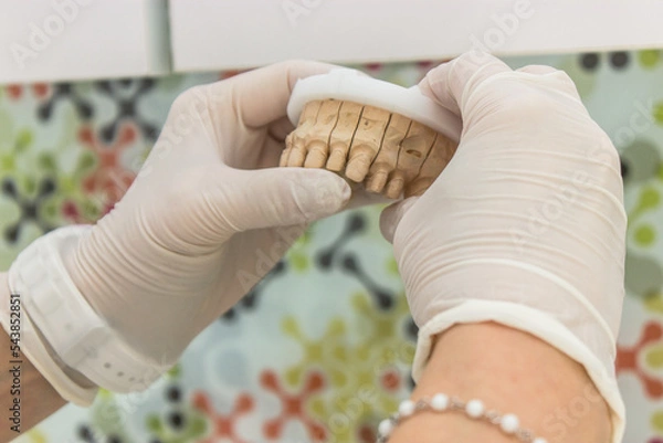 Obraz dentist  teeth mold
