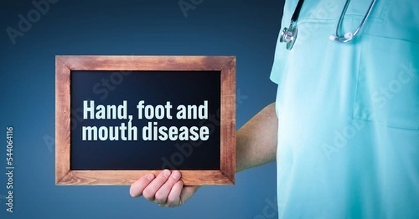 Fototapeta Hand, foot and mouth disease. Doctor shows sign/board with wooden frame. Background blue