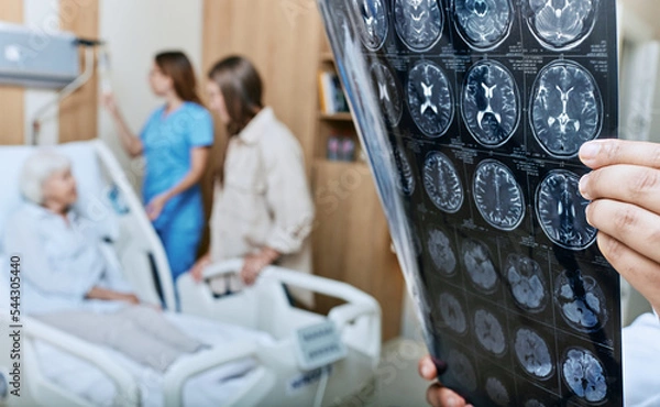 Fototapeta MRI of head of elderly woman in hands of doctor standing in medical ward near senior patient with relative and nurse. Recovery after a stroke