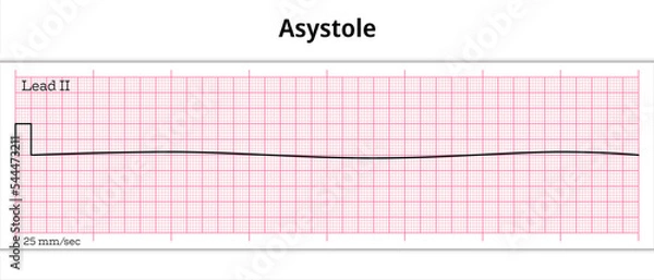 Obraz ECG Asystole - 8 Second ECG Paper