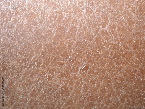 Obraz Dry skin or ichthyosis texture detail in women using for moisturizer lotion, cream or beauty product concept, motion. Closeup macro, blurred.
