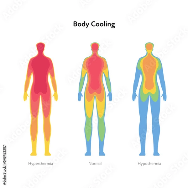 Obraz Hyperthermia and hypothermia health care infographic. Vector flat healthcare illustration. Body cooling infrared heat map isolated on white background.