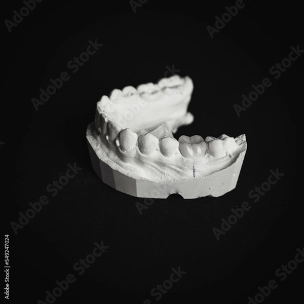 Obraz Impresión bucal