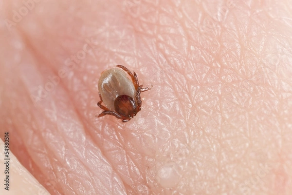 Fototapeta Tick, Ixodes ricinus biting human, extreme close-up