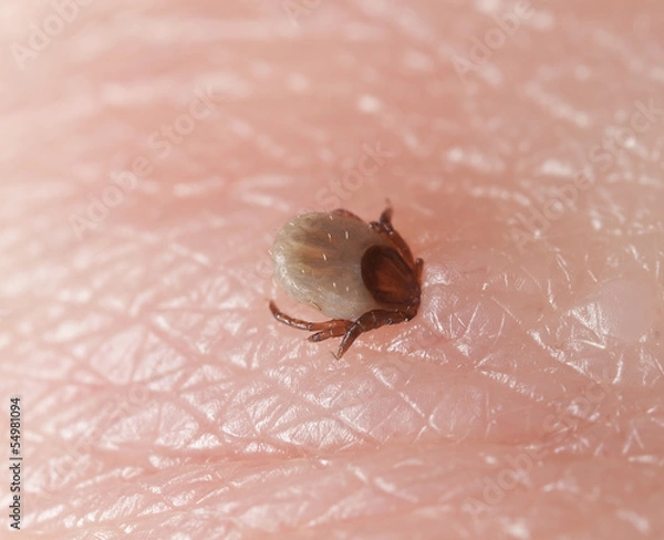 Fototapeta Tick, Ixodes ricinus biting human