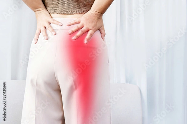 Obraz Sciatica Pain concept with woman suffering from buttock pain spreading to down leg