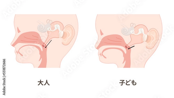 Fototapeta 大人と子どもの耳管のイラスト_矢状断