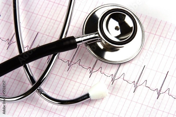 Obraz A stethoscope over a electrocardiogram close up.