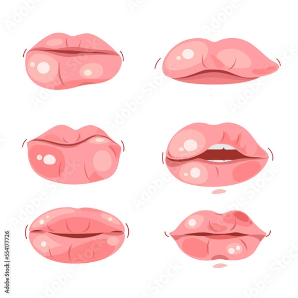 Fototapeta swollen lips