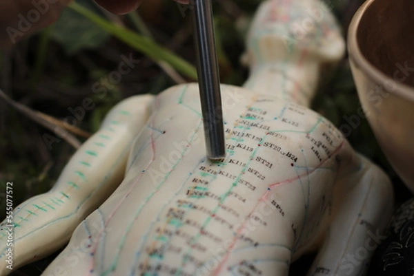 Obraz acupuncture  et sonothérapie