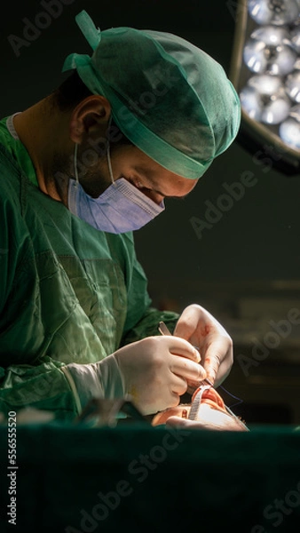 Obraz rhinoplasty surgery, defects in the shape of the nose in the female patient. Surgical intervention in plastic surgery rhinoplasty 