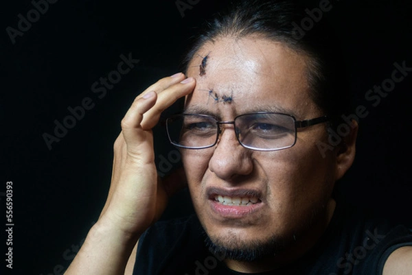 Obraz portrait of a latino man with 6 stitches on his forehead, who has headaches