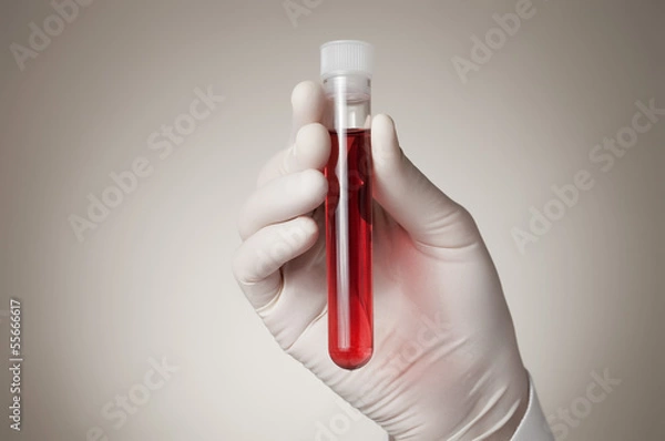 Obraz Doctor's hand with blood sample
