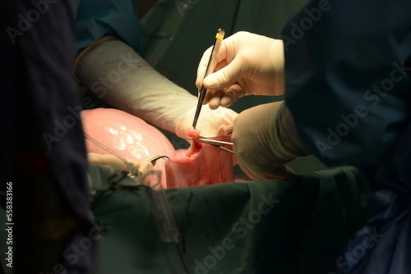 Fototapeta Kolik Operation beim Pferd, Details