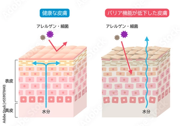 Obraz 乾燥肌とバリア機能の整った健康な皮膚　肌細胞と断面図
